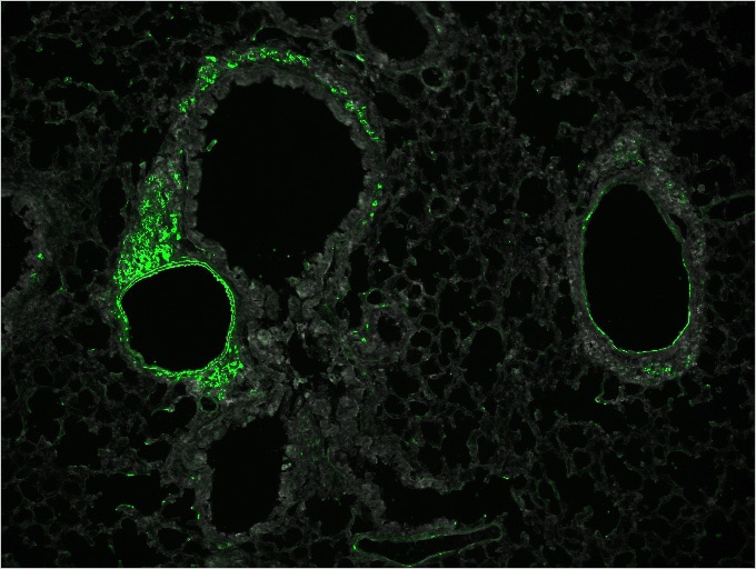 图片：荧光免疫染色后的哮喘症状的肺部……